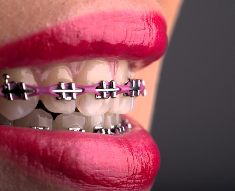 Ortodoncja ortodoncja lubin