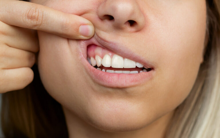 Periodontologia periodontolog lubin