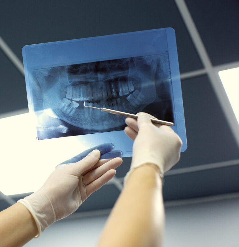 RTG zębów rtg zębów lubin